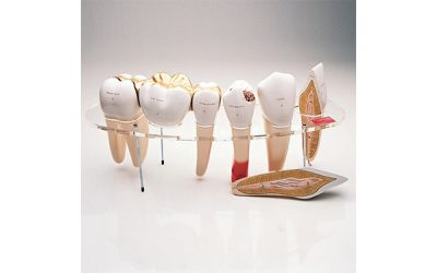 Bộ hình thái răng